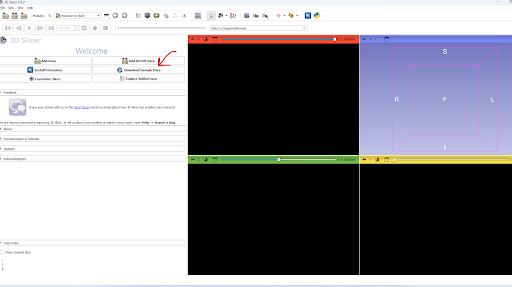 image_tooltip alt_text